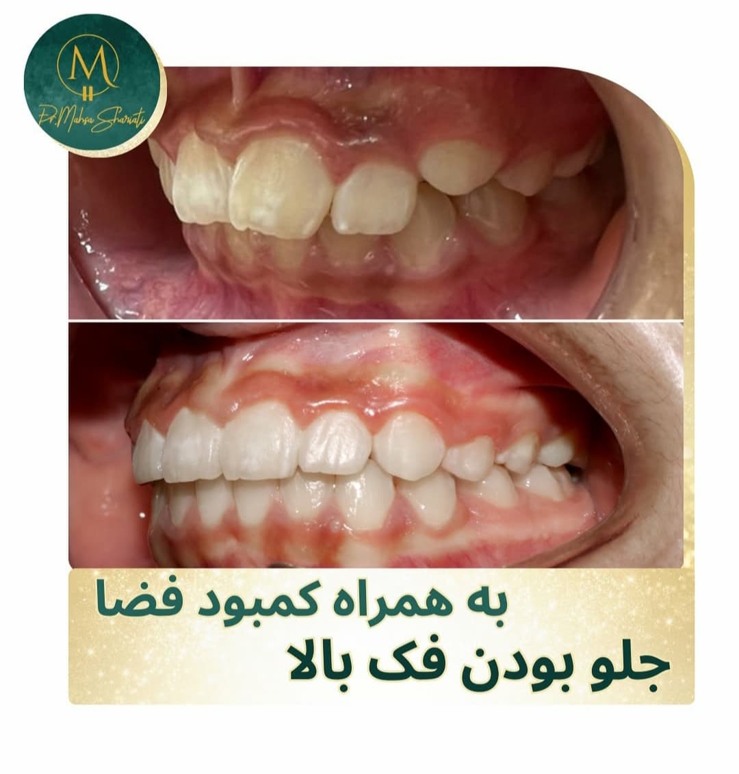 کلینیک تخصصی ارتودنسی دکتر مهسا شریعتی در خیابان شریعتی تهران