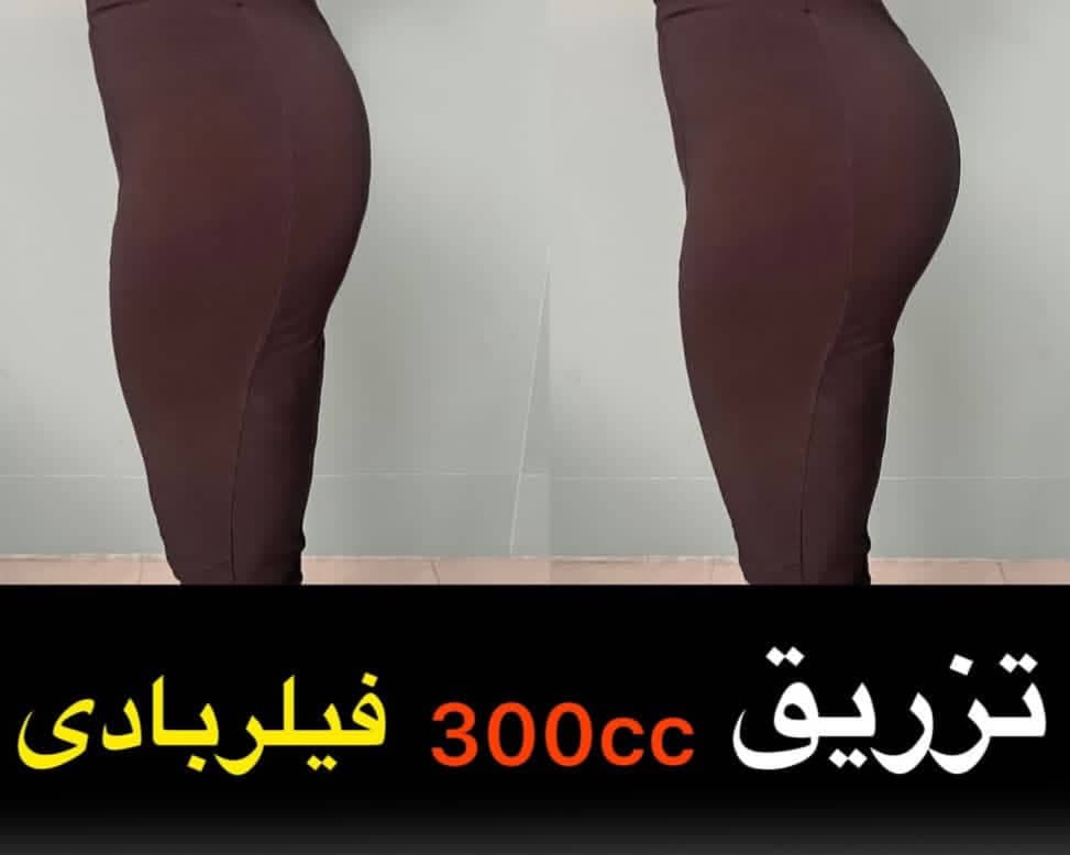 کلینیک تزریق فیلر بادی باسن و بیکینی دکتر نیلوفر والی در زعفرانیه تهران