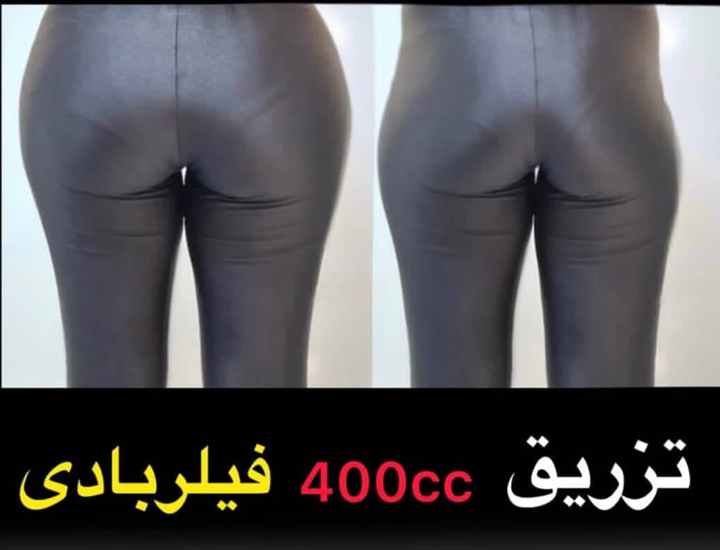 کلینیک تزریق فیلر بادی باسن و بیکینی دکتر نیلوفر والی در زعفرانیه تهران