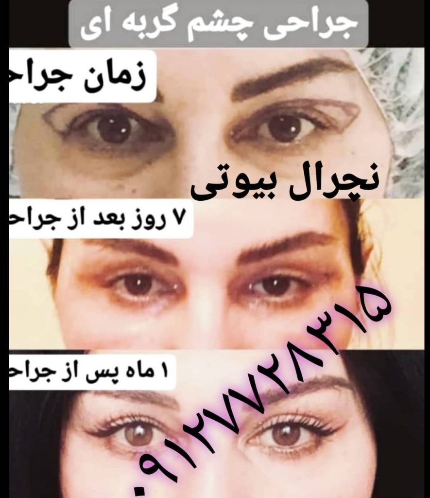 کلینیک زیبایی دکتر تقوی در تهران 