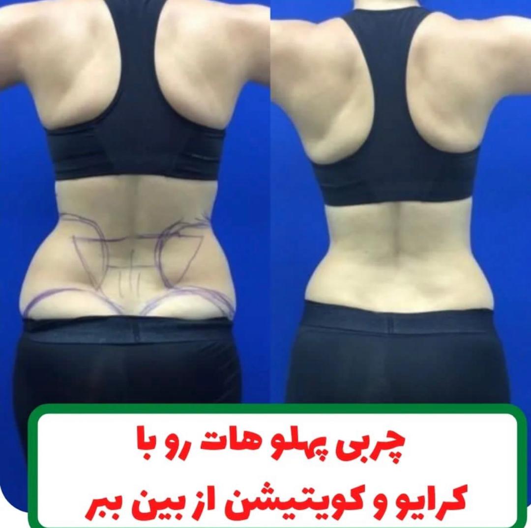 کلینیک لاغری و رژیم درمانی فخر ،آدرس کلینیک لاغری و رژیم درمانی فخر ،ایران مشاغل سامانه برتر ثبت مشاغل کشور