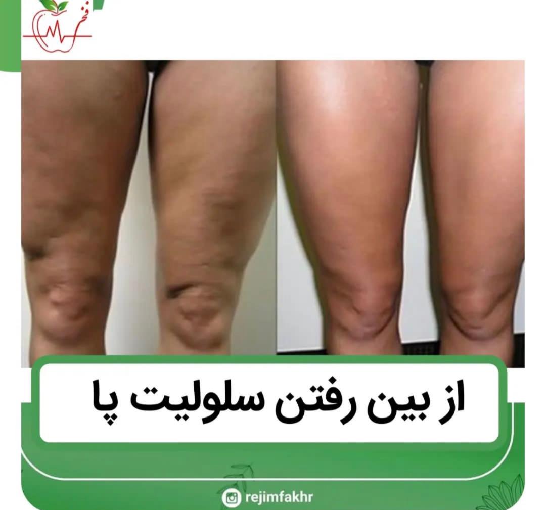 کلینیک لاغری و رژیم درمانی فخر ،آدرس کلینیک لاغری و رژیم درمانی فخر ،ایران مشاغل سامانه برتر ثبت مشاغل کشور