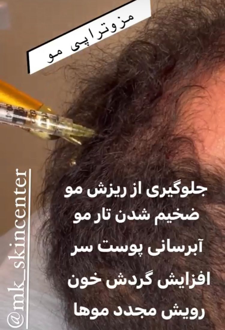 کلینیک تخصصی پوست دکتر علی پور در کرج ،آدرس کلینیک تخصصی پوست دکتر علی پور در کرج ،ایران مشاغل سامانه برتر ثبت مشاغل کشور