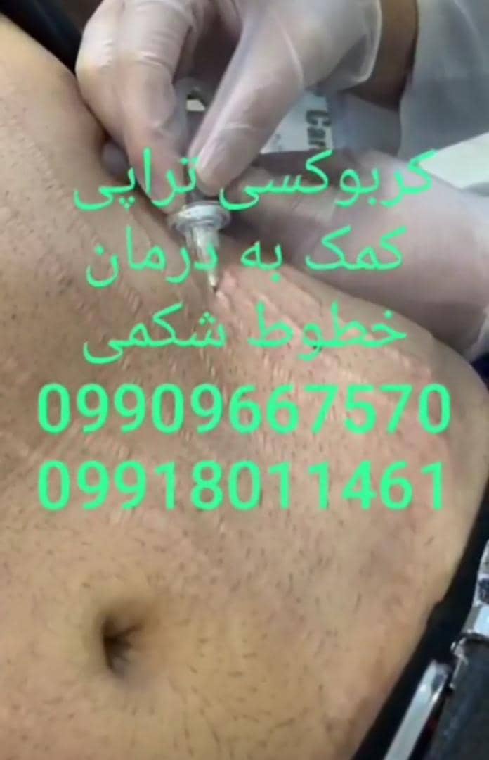 مطب زیبایی دکتر ثریا صفری در ایلام ،آدرس مطب زیبایی دکتر ثریا صفری در ایلام ،ایران مشاغل سامانه برتر ثبت مشاغل کشور