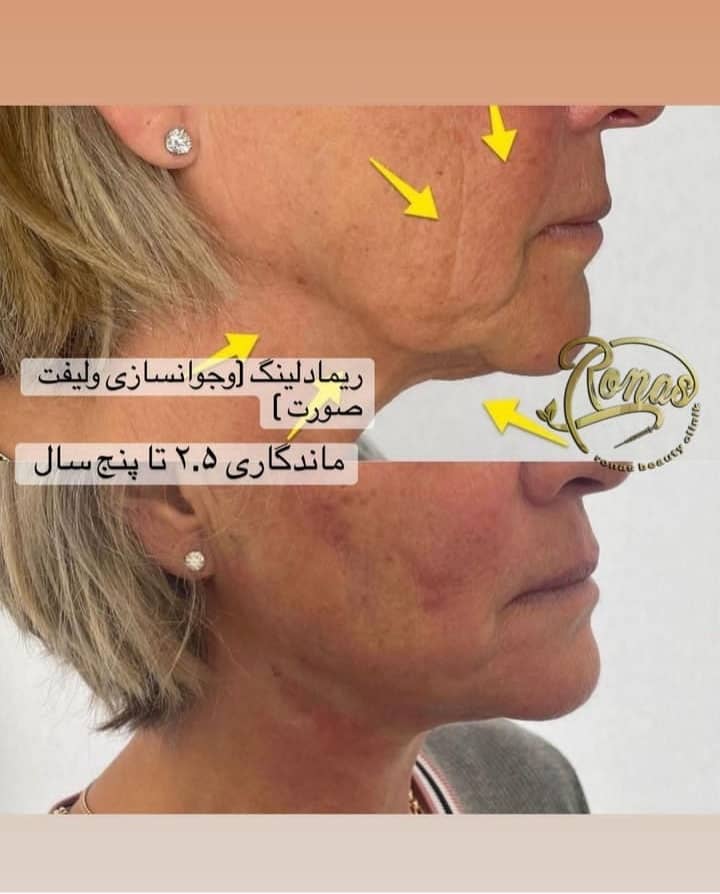 مرکز اندولیفت و لیزر روناس در بوشهر ،آدرس مرکز اندولیفت و لیزر روناس در بوشهر،ایران مشاغل سامانه برتر ثبت مشاغل کشور