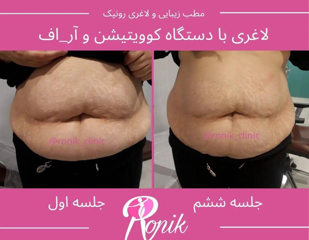 مطب زیبایی رونیک در خمینی شهر اصفهان ،آدرس مطب زیبایی رونیک در خمینی شهر اصفهان ،ایران مشاغل سامانه برتر ثبت مشاغل کشور