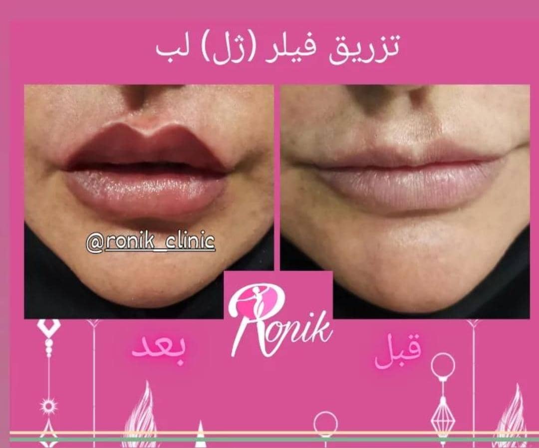 مطب زیبایی رونیک در خمینی شهر اصفهان ،آدرس مطب زیبایی رونیک در خمینی شهر اصفهان ،ایران مشاغل سامانه برتر ثبت مشاغل کشور