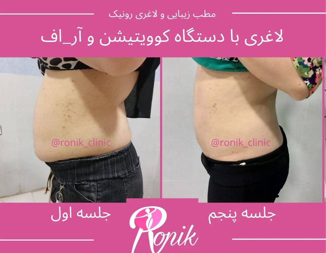 مطب زیبایی رونیک در خمینی شهر اصفهان ،آدرس مطب زیبایی رونیک در خمینی شهر اصفهان ،ایران مشاغل سامانه برتر ثبت مشاغل کشور