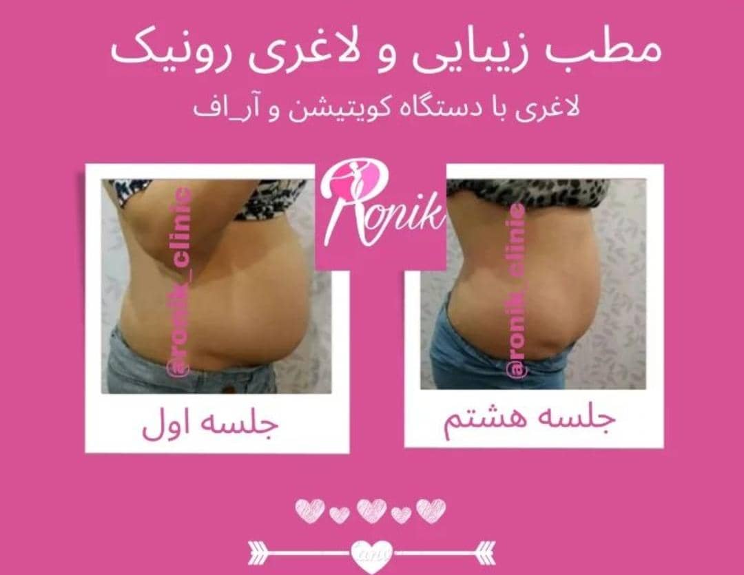 مطب زیبایی رونیک در خمینی شهر اصفهان ،آدرس مطب زیبایی رونیک در خمینی شهر اصفهان ،ایران مشاغل سامانه برتر ثبت مشاغل کشور