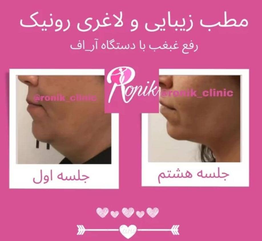 مطب زیبایی رونیک در خمینی شهر اصفهان ،آدرس مطب زیبایی رونیک در خمینی شهر اصفهان ،ایران مشاغل سامانه برتر ثبت مشاغل کشور