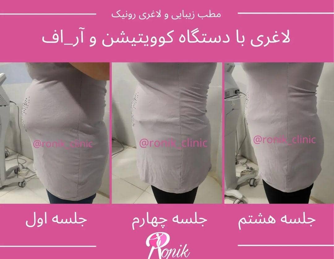 مطب زیبایی رونیک در خمینی شهر اصفهان ،آدرس مطب زیبایی رونیک در خمینی شهر اصفهان ،ایران مشاغل سامانه برتر ثبت مشاغل کشور