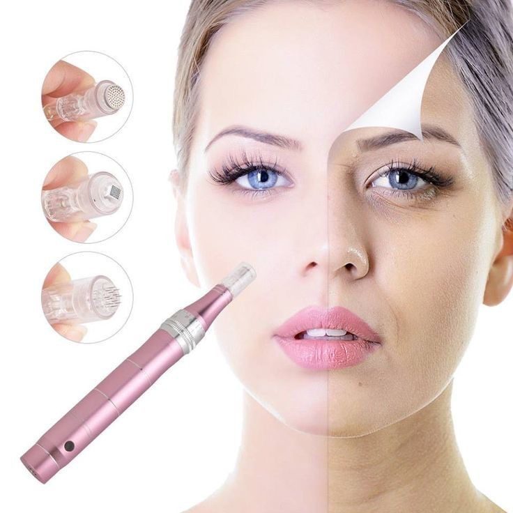 میکرودرم ابریژن چیست ؟