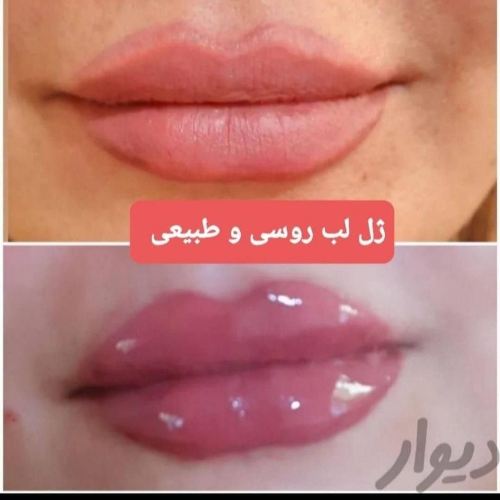 کلینیک پزشکی و زیبایی پوست مو سایه در نواب رشت