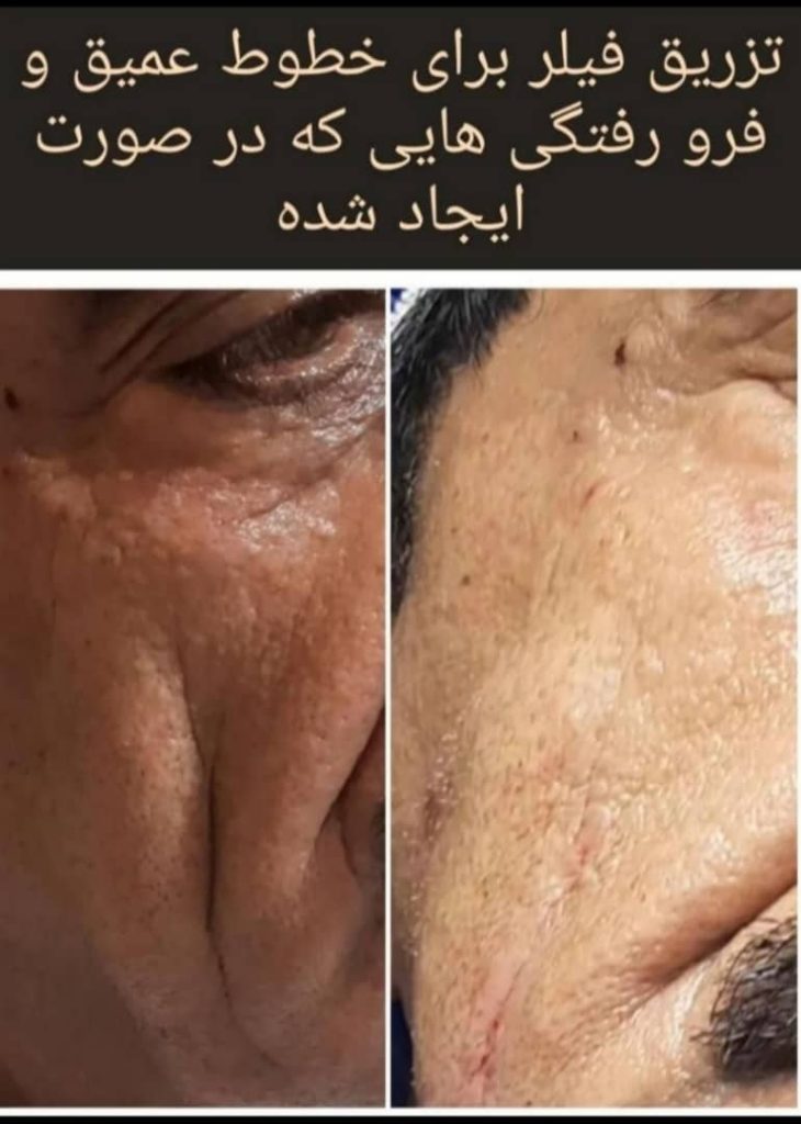 کلینیک پزشکی و زیبایی پوست مو سایه در نواب رشت