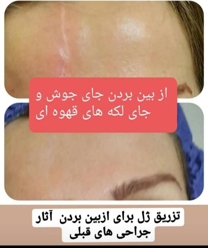 کلینیک پزشکی و زیبایی پوست مو سایه در نواب رشت