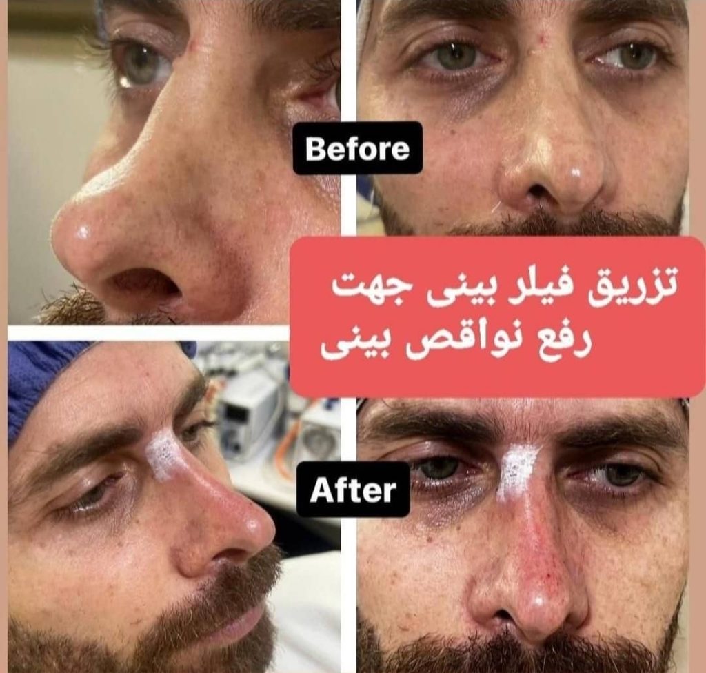 کلینیک پزشکی و زیبایی پوست مو سایه در نواب رشت