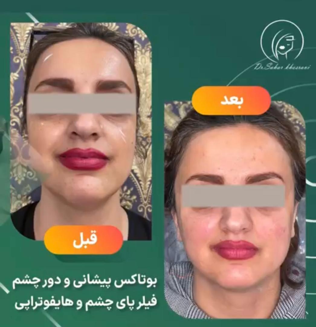 کلینیک زیبایی پوست و مو و بوتاکس و کانتورینگ دکتر سحر خسروی در تهران ، آدرس کلینیک زیبایی پوست و مو و بوتاکس و کانتورینگ دکتر سحر خسروی در تهران ، ایران مشاغل سامانه برتر ثبت مشاغل کشور