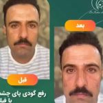 کلینیک زیبایی پوست و مو و بوتاکس و کانتورینگ دکتر سحر خسروی در تهران