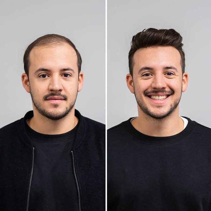 پی آر پی مو ،ایران مشاغل سامانه برتر ثبت مشاغل کشور