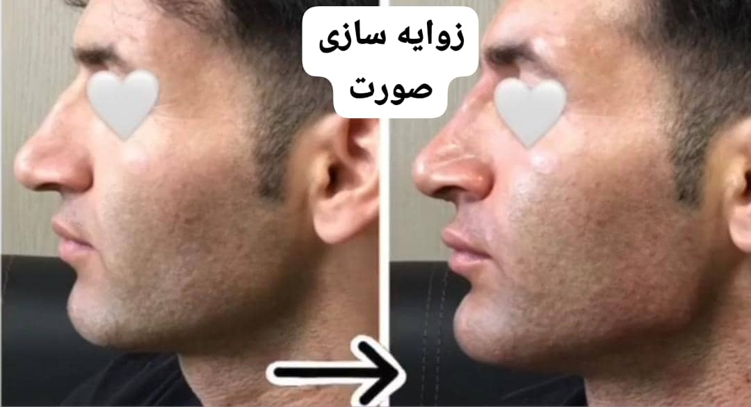 مطب پوست و مو و زیبایی دکتر مهین پاکدل در تهران ، آدرس مطب پوست و مو و زیبایی دکتر مهین پاکدل در تهران ، ایران مشاغل سامانه برتر ثبت مشاغل کشور