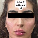 مطب پوست و مو و زیبایی دکتر مهین پاکدل در تهران