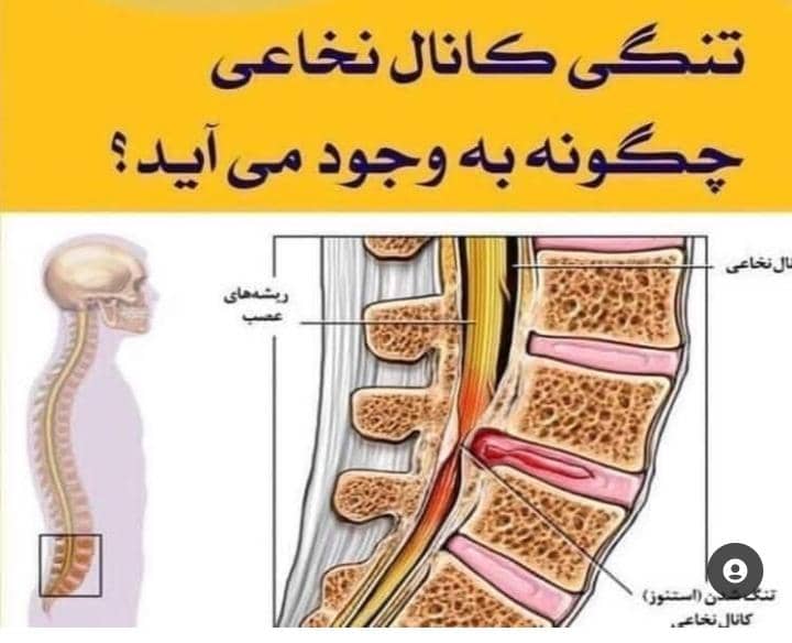 دکتر محمد ابوئی درمان انواع بیماری های تنفسی در یزد ، آدرس دکتر محمد ابوئی درمان انواع بیماری های تنفسی در یزد ، ایران مشاغل سامانه برتر ثبت مشاغل کشور