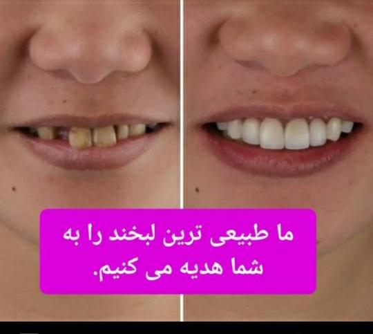 مطب دندانپزشکی دکتر هدیه هدایت زاده در رشت ،ادرس مطب دندانپزشکی دکتر هدیه هدایت زاده در رشت ،ایران مشاغل سامانه برتر ثبت مشاغل کشور 