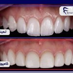 مطب دندانپزشکی دکتر کژال فیلی در سنندج کامیاران