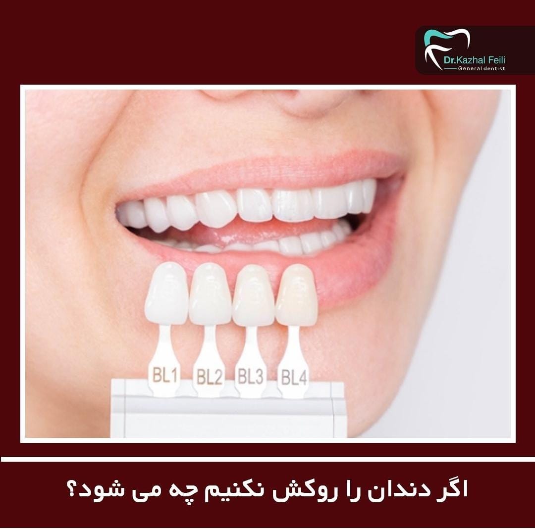 مطب دندانپزشکی دکتر کژال فیلی در سنندج کامیاران ،آدرس مطب دندانپزشکی دکتر کژال فیلی در سنندج کامیاران ،ایران مشاغل سامانه برتر ثبت مشاغل کشور 