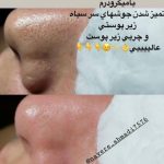 سالن زیبایی و فیشیال پوست آرامیس در سمنان