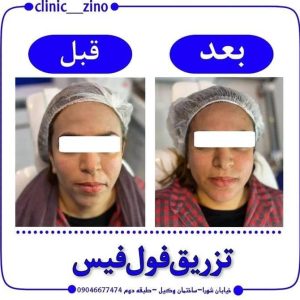 کلینیک زیبایی زینو در برازجان بوشهر ، آدرس کلینیک زیبایی زینو در برازجان بوشهر ، کلینیک زیبایی در بوشهر ، ایران مشاغل سامانه برتر ثبت مشاغل کشور