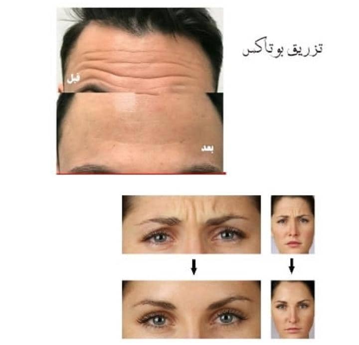 کلینیک زیبایی هوژین در رفسنجان ، آدرس کلینیک زیبایی هوژین در رفسنجان ، ایران مشاغل سامانه برتر ثبت مشاغل کشور