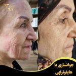 کلینیک زیبایی ژنوس در تبریز