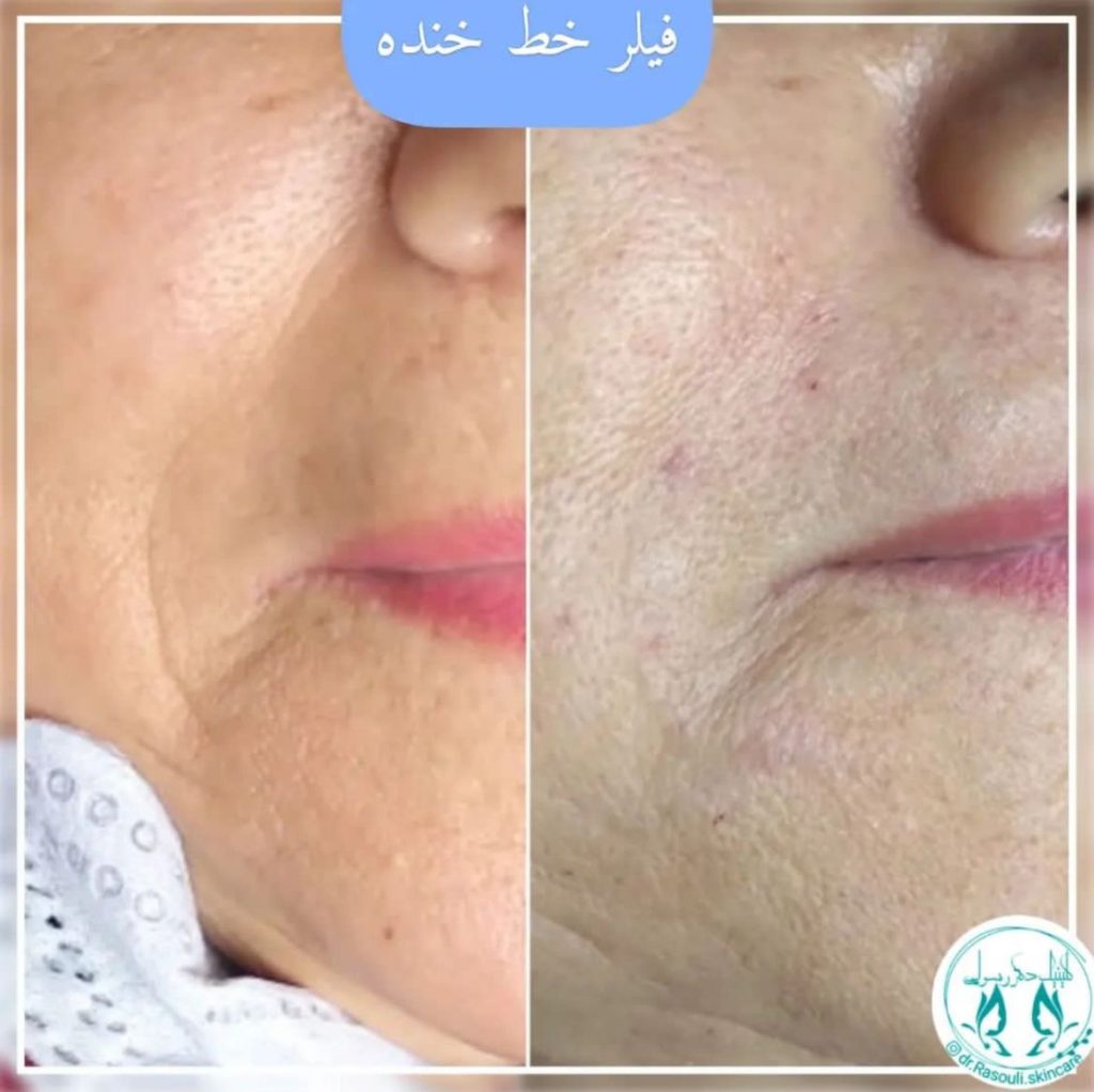 کلینیک زیبایی دکتر رسولی در آستانه اشرفیه