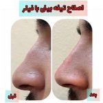 کلینیک تخصصی پوست مو و زیبایی آدینا در شهریار تهران