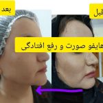 کلینیک زیبایی آدرینا در خرم آباد