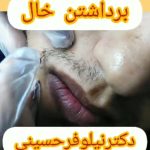 کلینیک لاغری پوست لیزر و زیبایی دکتر نیلوفر حسینی در گوهردشت کرج