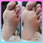 مرکز تخصصی پاکسازی پوست فاطمه کرمانی در قم