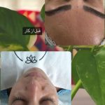 مرکز تخصصی پاکسازی پوست فاطمه کرمانی در قم