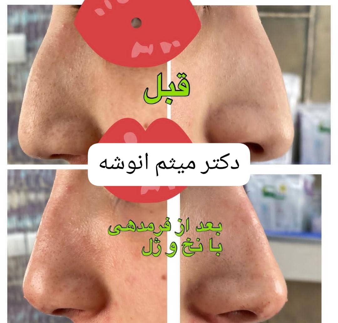 مطب پوست و زیبایی دکتر میثم انوشه در ارومیه ، آدرس مطب پوست و زیبایی دکتر میثم انوشه در ارومیه ، ایران مشاغل سامانه برتر ثبت مشاغل کشور