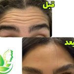 کلینیک تخصصی پوست مو و زیبایی آدینا در شهریار تهران