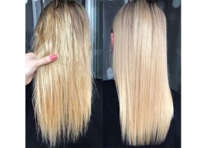 بوتاکس مو چیست