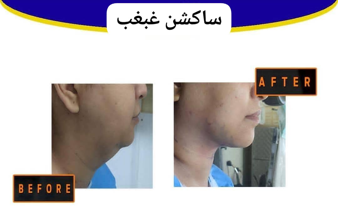 کلینیک تخصصی زیبایی پوست و مو تندیس سلامت در مشهد ، آدرس کلینیک تخصصی زیبایی پوست و مو تندیس سلامت در مشهد ، ایران مشاغل سامانه برتر ثبت مشاغل کشور