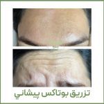 کلینیک زیبایی پوست مو و لیزر پرانا در بندرعباس