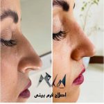 کلینیک زیبایی پوست و مو اعظم در عظیمیه کرج