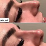 کلینیک زیبایی پوست مو و لیزر هستی محمدی در اصفهان