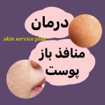 کلینیک زیبایی و درمانی اسکین سرویس پلاس در نوشهر