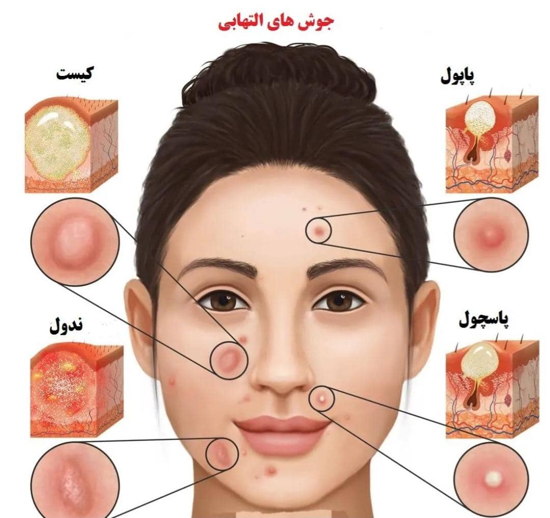 کلینیک زیبایی و درمانی اسکین سرویس پلاس در نوشهر ،آدرس کلینیک زیبایی و درمانی اسکین سرویس پلاس در نوشهر ،ایران مشاغل سامانه برتر ثبت مشاغل کشور