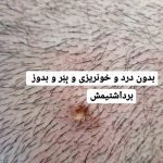 مرکز و کلینیک زیبایی لیزر ژل بوتاکس دکتر آرین صفری در نکا