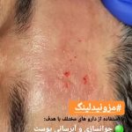 مرکز و کلینیک زیبایی لیزر ژل بوتاکس دکتر آرین صفری در نکا